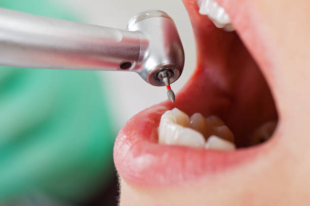 Best Emergency Wisdom Teeth Removal in Wewahitchka, FL